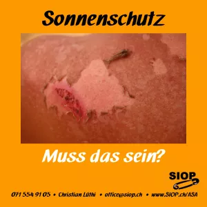 Sonnenschutz am Arbeitsplatz: Jetzt umsetzen, bevor es zu spät ist! Sonnenschutz am Arbeitsplatz: Jetzt umsetzen, bevor es zu spät ist!